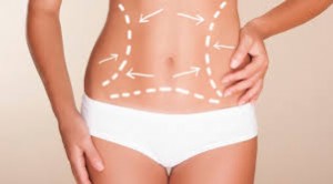 Abdominoplastie Tunisie Abdominoplastie Tunisie